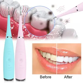 Elektrikli Ultrasonik Ölçekleyici Diş Calculus Remover Temizleyici Diş Lekeleri Tartar Damla Araçları Beyazlatmak Diş Nakliye N1U2